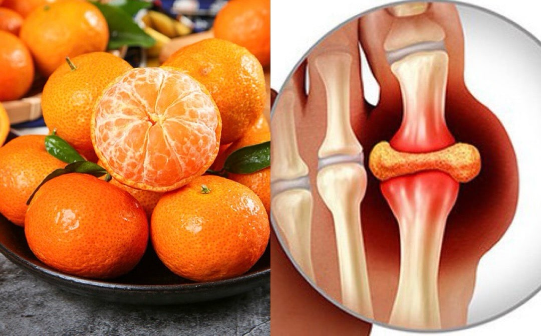 Ingredients in tangerines help reduce uric acid. Graphics: Huong Giang