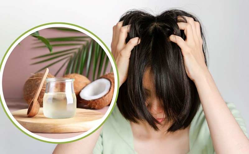 Coconut oil helps reduce itchy scalp. Graphics: Thanh Thanh