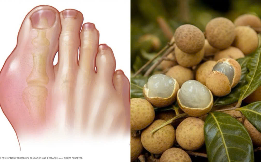 Notes when eating longan to avoid increasing uric acid. Graphics: Huong Giang