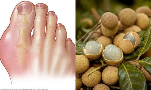 Những lưu ý khi ăn nhãn tránh tăng axit uric. Đồ họa: Hương Giang