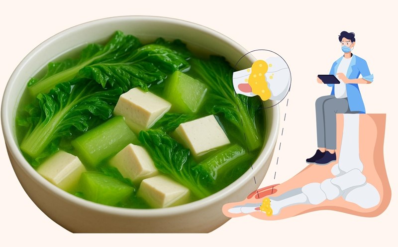 A refreshing vegetable soup helps reduce uric acid. Graphics: Linh Dan