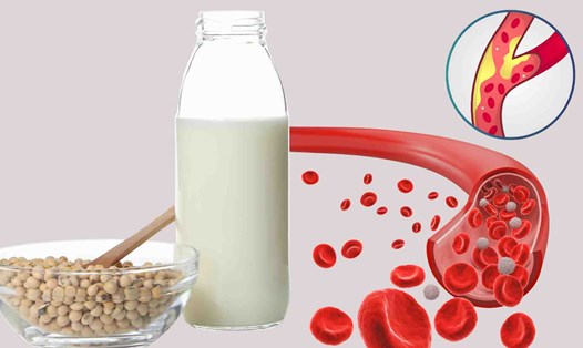 Sữa đậu nành không đường giúp giảm mỡ máu. Đồ họa: Hạ Mây