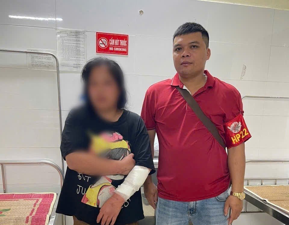 Tien Lang 면 공안 HP22 근무조는 N.T.T 씨를 Tien Lang 현 보건소로 데려가 응급 처치를 하고 상처를 봉합했습니다. 사진: Hai Phong 시 공안