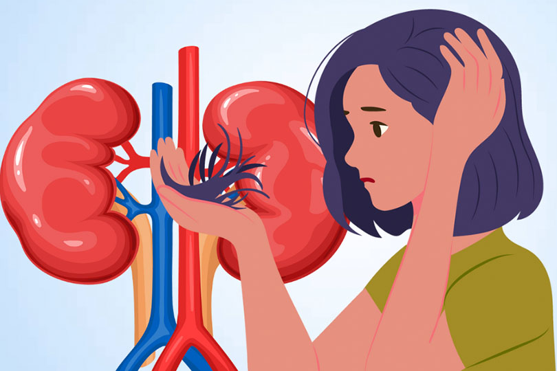 Hair loss can be a warning sign of kidney problems. Graphics: Thien Nhan