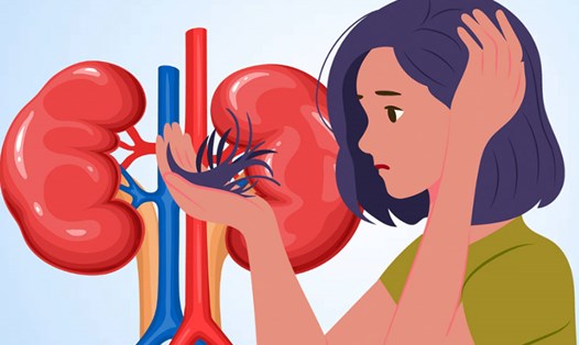 Rụng tóc có thể là dấu hiệu cảnh báo thận gặp vấn đề. Đồ họa: Thiện Nhân