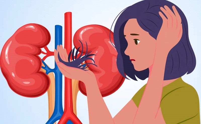 Hair loss can be a warning sign of kidney problems. Graphics: Thien Nhan