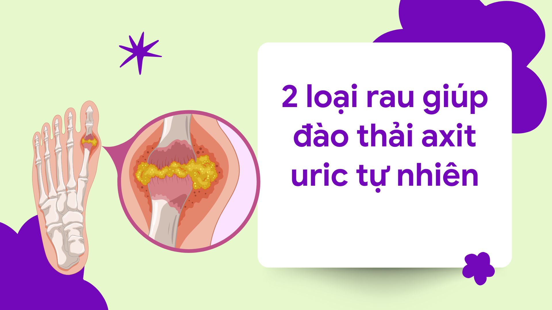 브로콜리는 요산 배출을 효과적으로 지원합니다. 그래픽 이미지: Huong Son