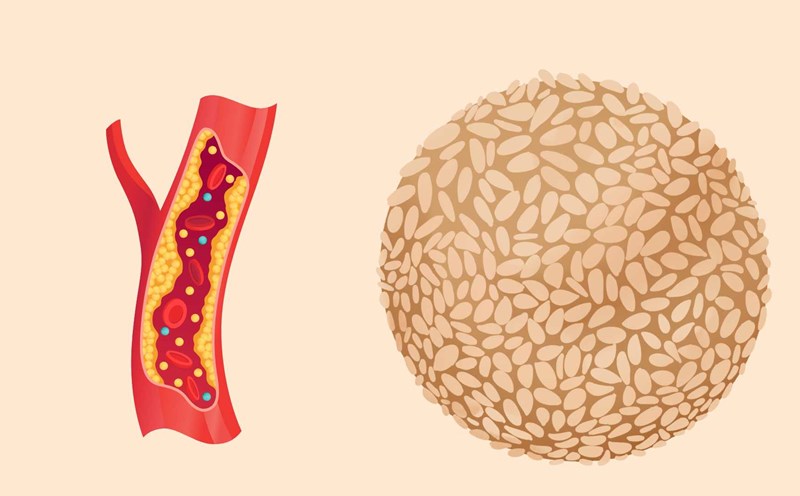 Sesame seeds can effectively support blood fat reduction. Graphic photo: Hoang Loc