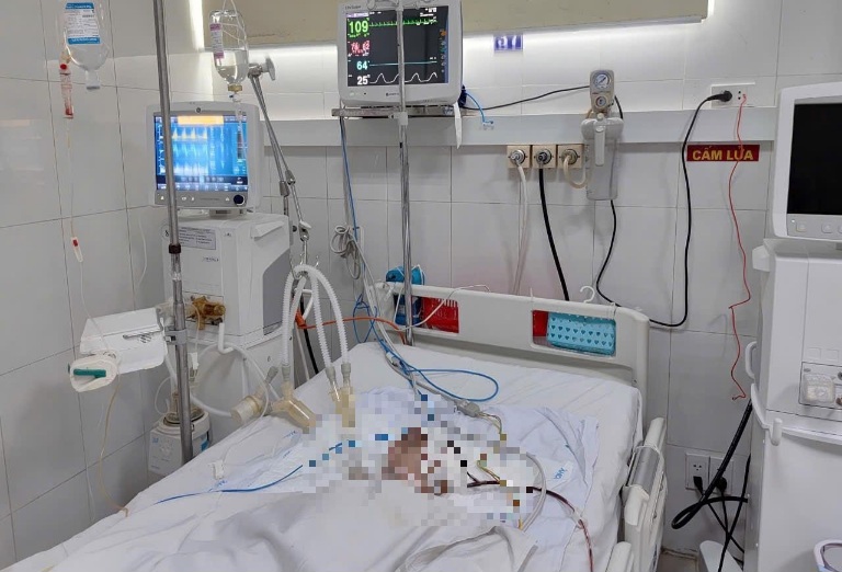 Mot nan nhan 1 tuoi bi chan thuong so nao, nguy kich. Anh: Benh vien cung cap