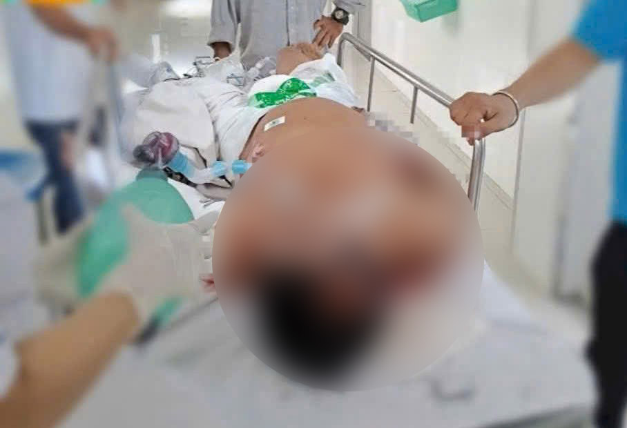 感電して高所から転落した後、Kさんはチャライ病院で積極的に治療を受けました。写真:家族提供