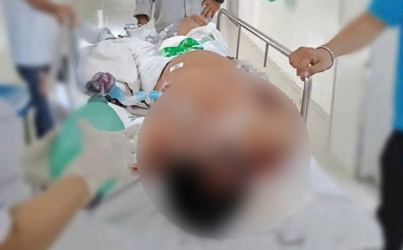 After being electrocuted and falling from a height, Mr. K was actively treated at Cho Ray Hospital. Photo: Provided by the family