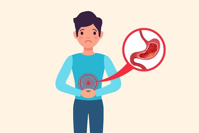 굶는 방법 고형식 및 액체 음식을 피하는 방법은 성공적인 수술 기회를 높이고 회복 시간을 단축하는 데 도움이 됩니다. 그래픽: 티엔 년