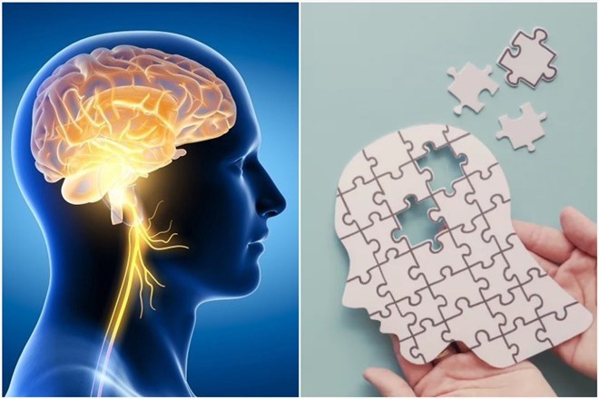 Taking measures to improve the brain such as getting enough sleep, exercising, proper nutrition and calmness helps improve brain health and prevent memory loss. Graphics: Thanh Thanh