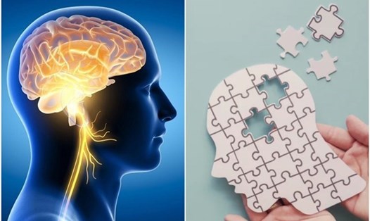 Thực hiện các biện pháp cải thiện não bộ như ngủ đủ giấc, tập thể dục, dinh dưỡng hợp lý và tĩnh lặng giúp nâng cao sức khỏe não và ngăn suy giảm trí nhớ. Đồ họa: Thanh Thanh