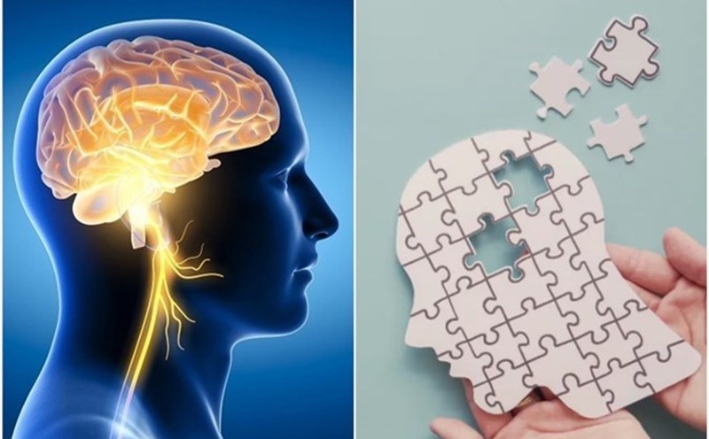 Taking measures to improve the brain such as getting enough sleep, exercising, proper nutrition and calmness helps improve brain health and prevent memory loss. Graphics: Thanh Thanh