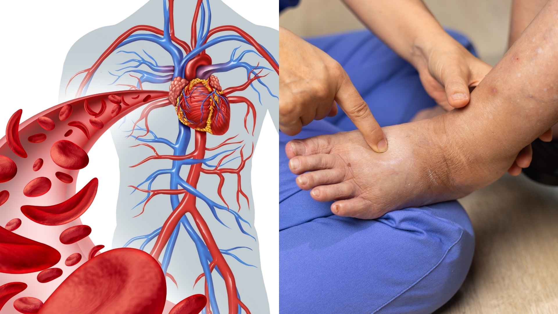 3 signs on the legs that warn of poor blood circulation