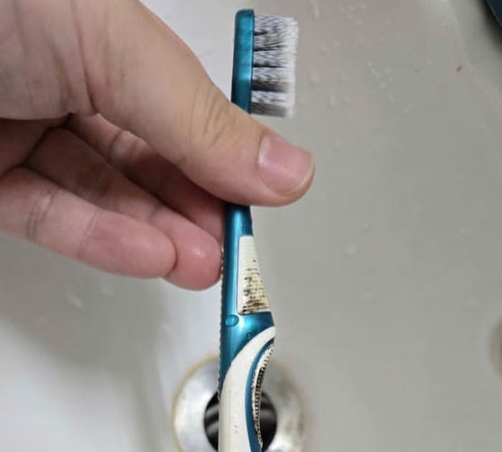 곰팡이가 핀 칫솔은 교체해야 할 징후 중 하나입니다. 사진: 뚜언 닷