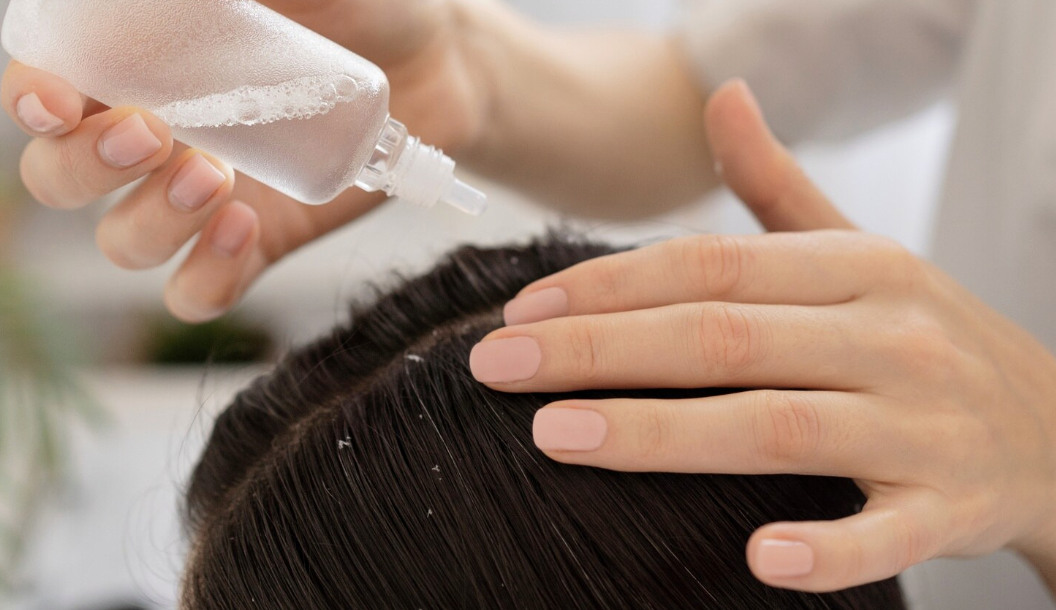 Unexpected effects of scalp exfoliation. Photo: Thuy Duong