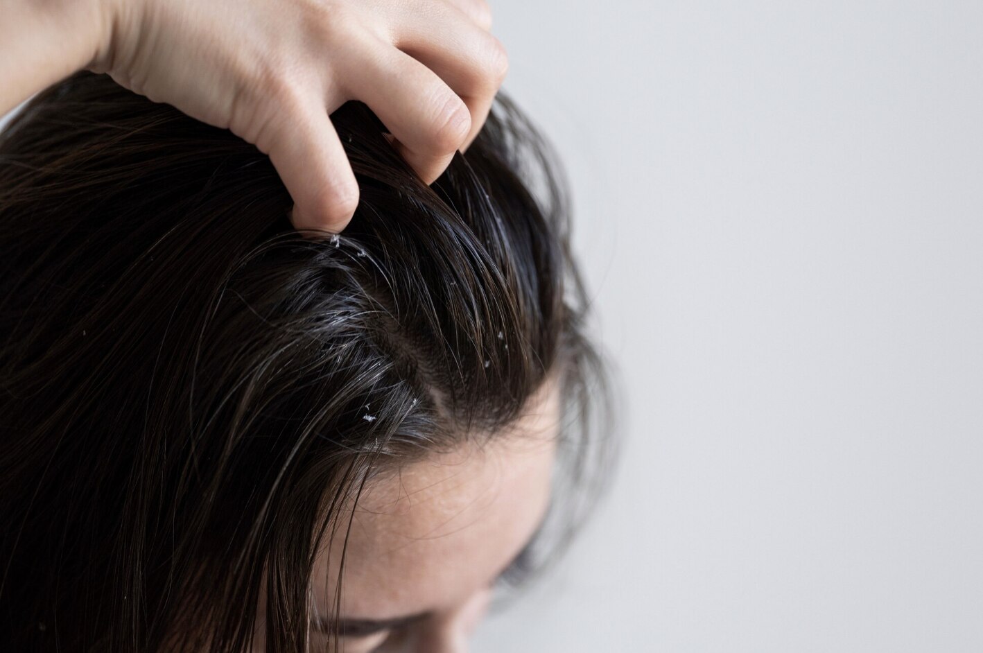 Oily goose, a small problem that causes big consequences in life. Photo: Thuy Duong