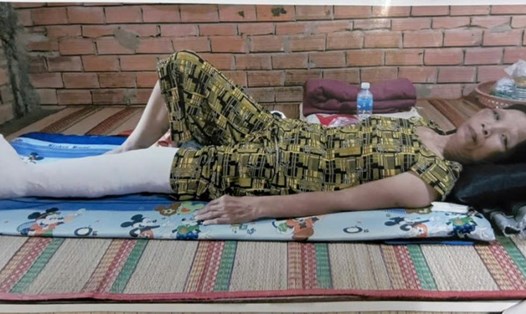 Bà Ngô Thị Thắng nằm liệt giường sau tai nạn, mọi sinh hoạt đều phải nhờ người thân chăm sóc. Ảnh: CTĐ xã Phú Phụng