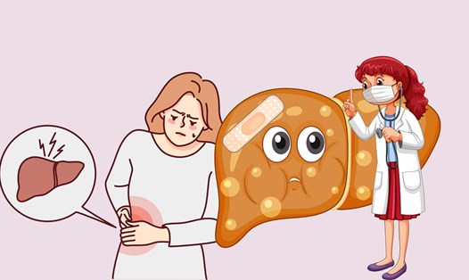 Gan nhiễm mỡ ảnh hưởng xấu đến sức khỏe. Ảnh đồ họa: Hoàng Lộc