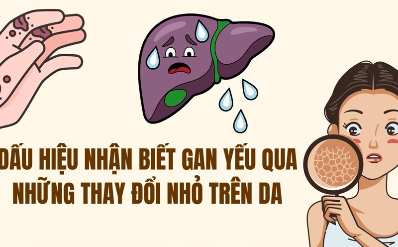 Signs of weak liver through small changes in the skin