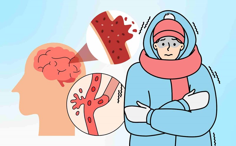 Simple ways to help the elderly prevent stroke when the weather turns cold