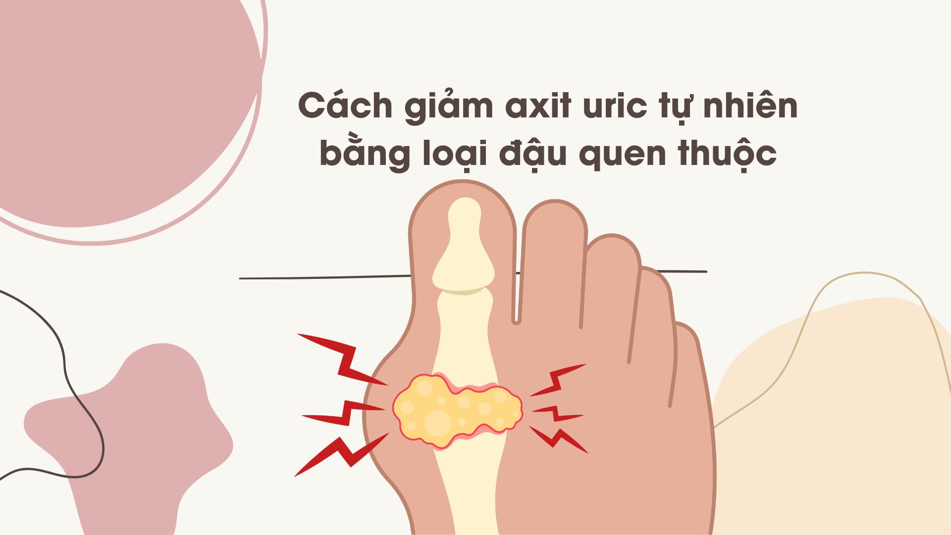 Les pommes vertes lorsqu'elles sont cuites ne doivent pas etre trop sucrees pour assurer une reduction de l'acide urique sans augmenter. Photo graphique : Huong Son