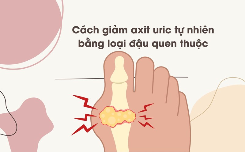 When cooking green beans, do not eat them too sweet to ensure that uric acid does not increase. Graphic photo: Huong Son