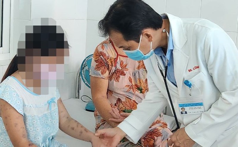Dr. CKII Tran Chi Cong examines a pediatric patient - Consulting, guiding care at Vinh Long General Hospital. Photo: Hoang Loc