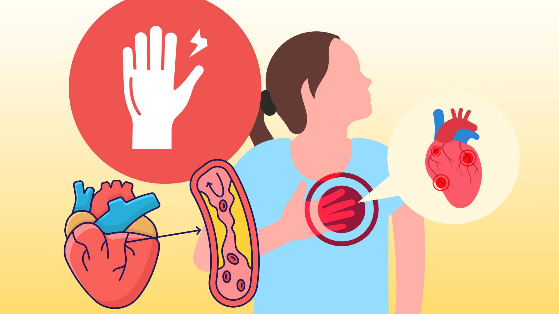 Signs on the hands warn of cardiovascular problems