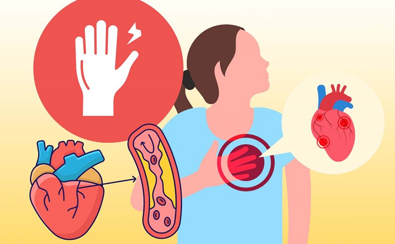Signs on the hands warn of cardiovascular problems