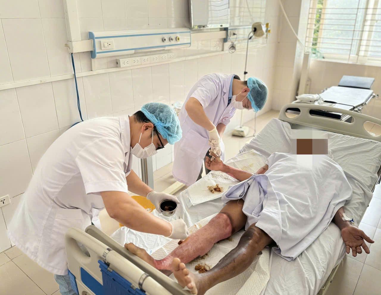 Doctors take care of a patient who suffered a burns due to an electrocardiogram explosion. Photo: Thanh Dang