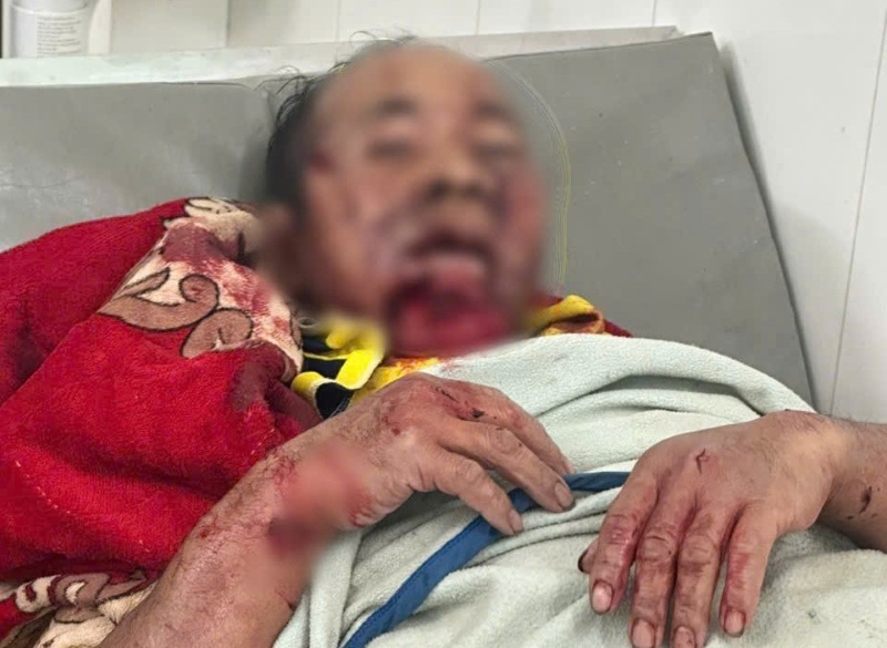 Truong thon o Da Nang bi gau rung tan cong giua duong vang, thoat chet trong gang tac. Anh: Hong Anh