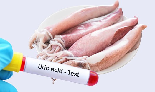 Mực thuộc nhóm thực phẩm có hàm lượng purin trung bình - tức là có thể làm tăng nồng độ axit uric trong máu nếu ăn sai thời điểm hoặc ăn quá nhiều. Ảnh đồ họa: Hoàng Lộc