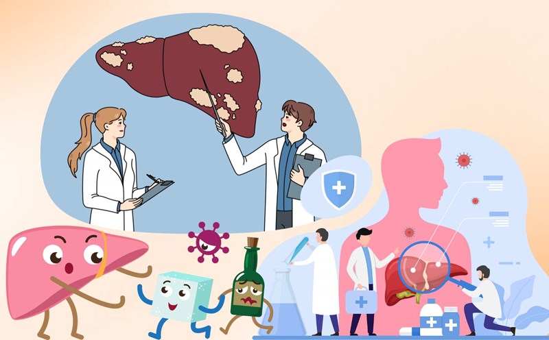 5 scientific habits to help you effectively prevent and improve fatty liver. Graphic photo: Hoang Loc