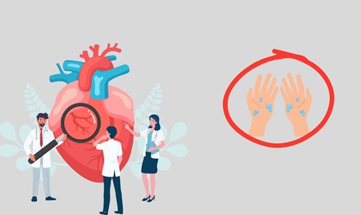 Phát hiện sớm bất thường về tim mạch bằng 2 dấu hiệu ở bàn tay. Đồ họa: Minh Châu