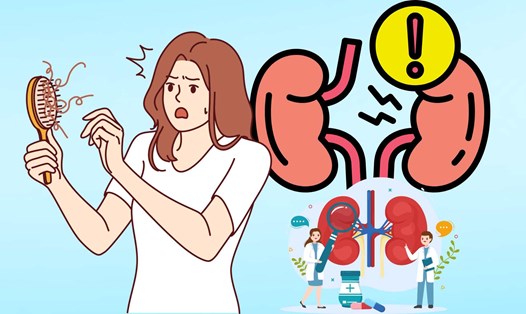 Rụng tóc nhiều kèm theo các dấu hiệu này, rất có thể thận của bạn đang gặp vấn đề