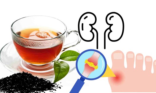 Uống trà đen đúng cách tốt cho chức năng thận và axit uric. Đồ họa: Hạ Mây