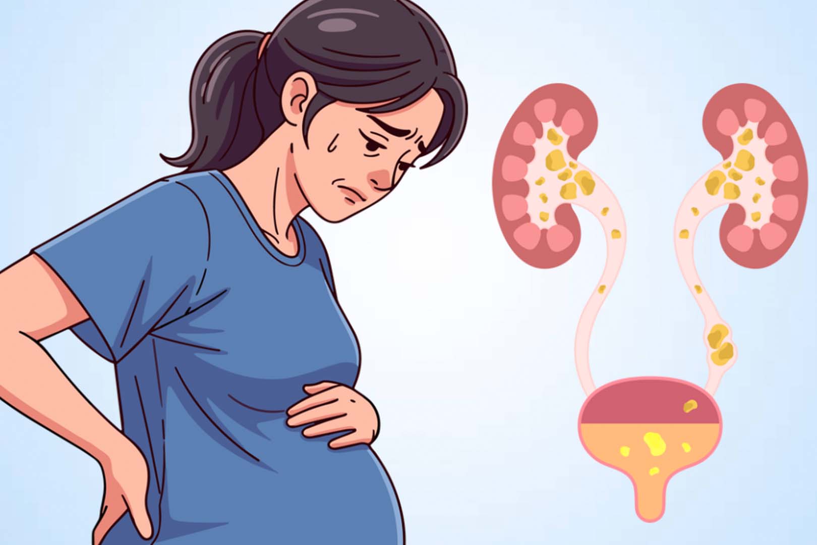 Durante el embarazo los niveles altos de hormonas hacen que los musculos del tracto urinario se relajen ralentizando el flujo de orina. Grafico: Thien Nhan