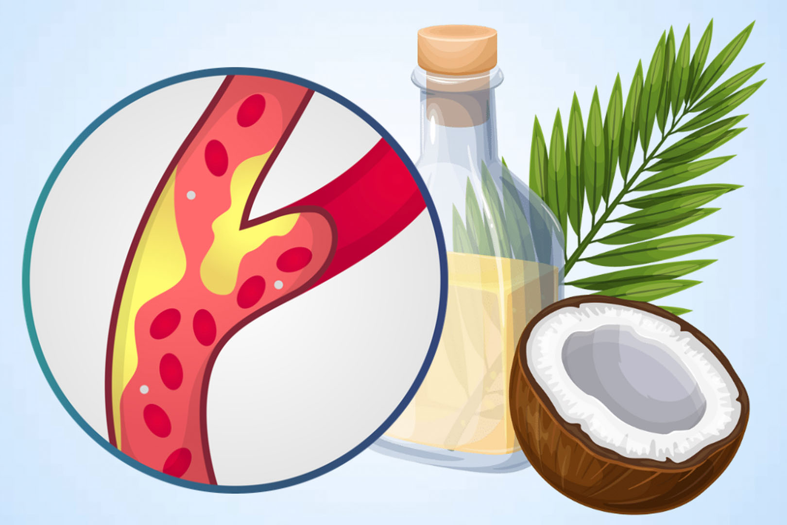 ココナッツミルクが体内のコレステロールレベルに及ぼす影響。グラフィック: ティエン・ナン