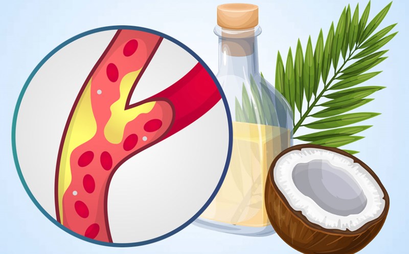 The impact of coconut milk on cholesterol levels in the body. Graphics: Thien Nhan