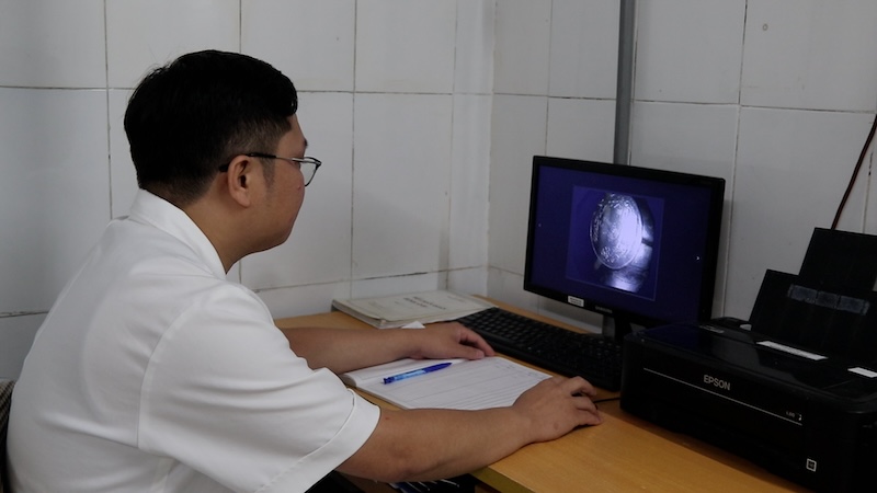 A 9-year-old child swallows a coins, the doctor warns of the risk of airway congestion when a foreign object falls into the lungs.