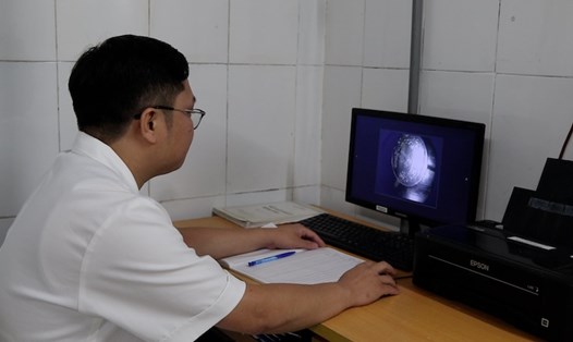 Bé 9 tuổi nuốt đồng xu, bác sĩ cảnh báo nguy cơ tắc đường thở khi dị vật rơi sang phổi.