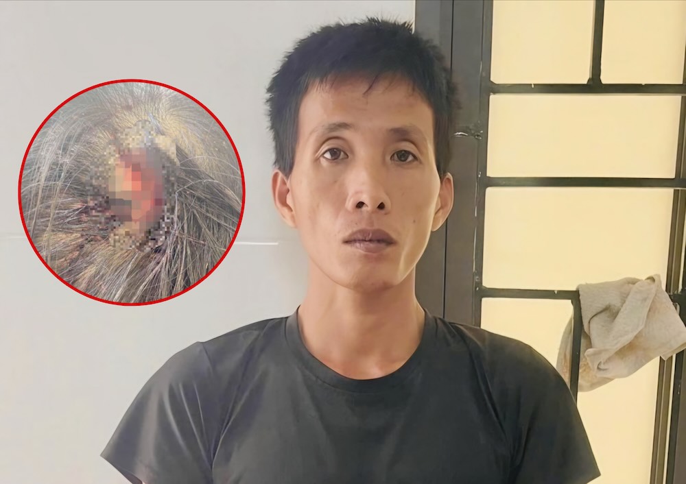 The stepfather used a hammer to hit a 10-year-old girl in Ha Tinh in the head and was prosecuted. Photo: Ha Tinh Police