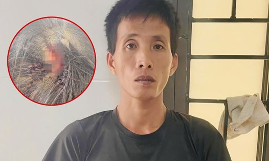 Cha dượng dùng búa đinh đánh vào đầu bé gái 10 tuổi ở Hà Tĩnh bị khởi tố. Ảnh: Công an Hà Tĩnh