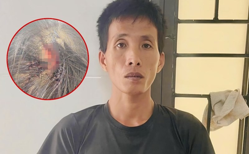 The stepfather used a hammer to hit a 10-year-old girl in Ha Tinh in the head and was prosecuted. Photo: Ha Tinh Police