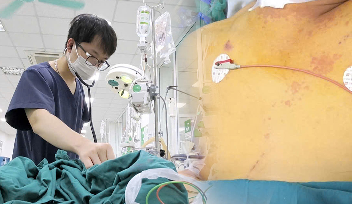 Warning of skin yellow spurs that broke out after floods, many serious hospitalizations