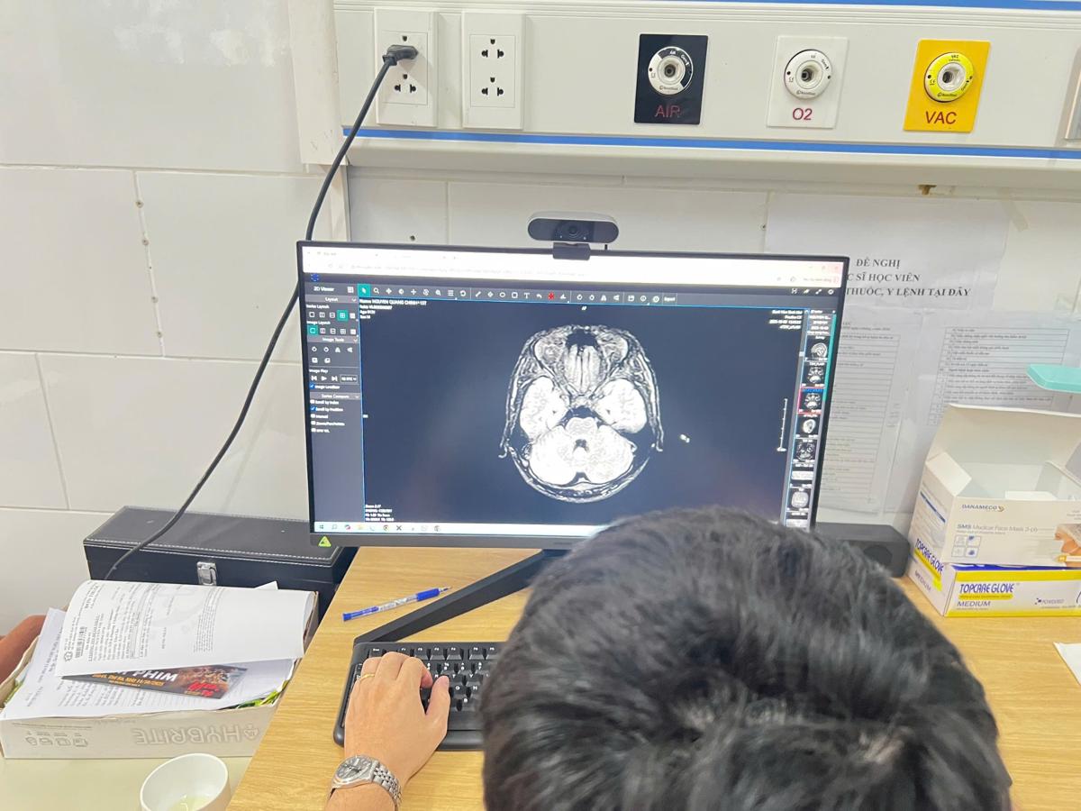 Bac si nghien cuu hinh chup X - quang de dua ra phap do dieu tri cho benh nhan. Anh: Duc Van