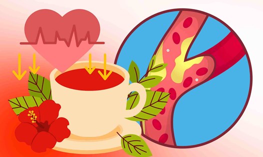 Đồ uống giúp hạ huyết áp và giảm nguy cơ xơ vữa động mạch